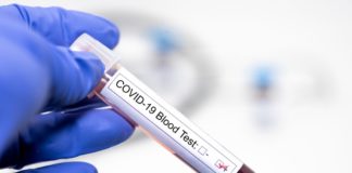 El Cabildo pide colaboración ciudadana para un proyecto de Sanidad que realizará más de 600 tests en la isla