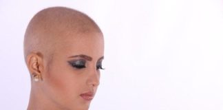 ¿Cómo tratar la caída de cabello?