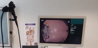 El Hospital Ntra. Sra. de Guadalupe incorpora un nuevo equipo de endoscopia de última generación
