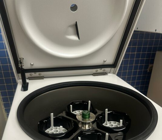 La Gerencia de Servicios Sanitarios de La Gomera instala centrífugas de muestras de sangre en las zonas básicas de salud